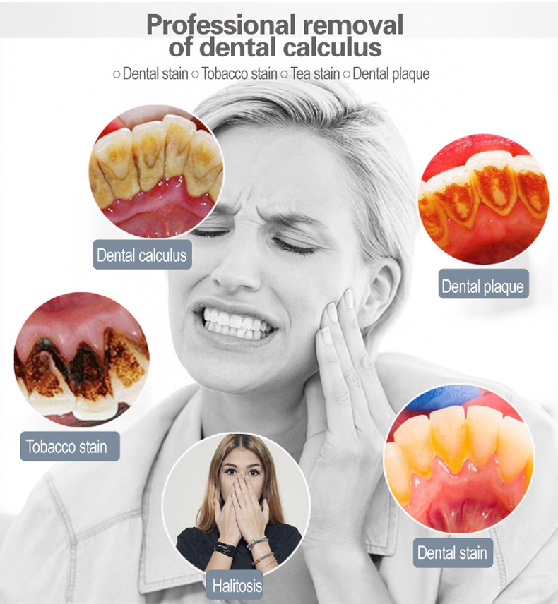 UltrasonicElectricDentalToothCleanerCleaningOralIrrigatorKitforTeethStainsPlaqueTeethWhiteningTeethC-1997986-5