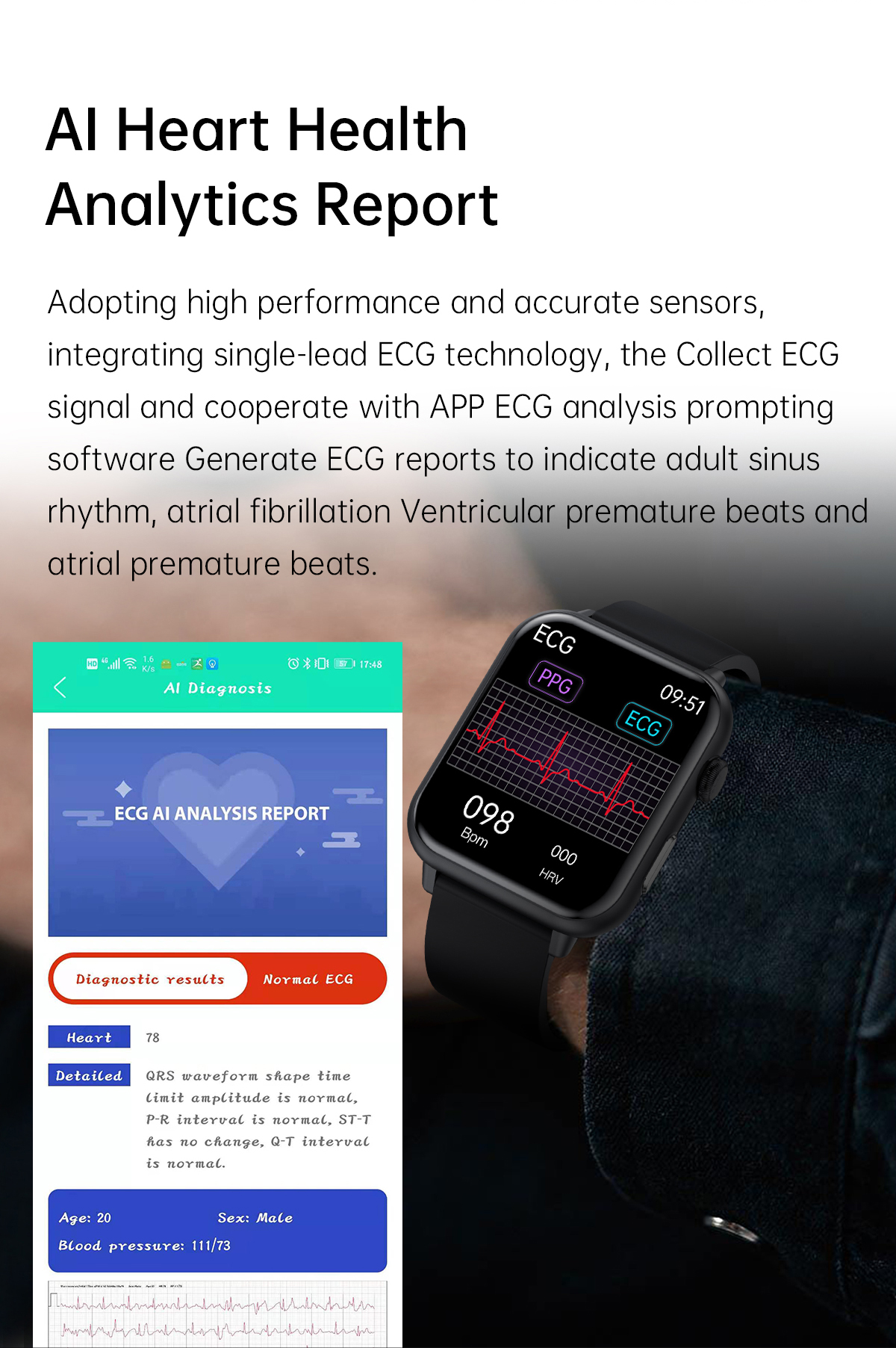 E200172inch356400pxHDScreenECGPPGHeartRateBloodPressureSpO2MonitorBodyTemperatureMeasurementAIHealth-1968505-6