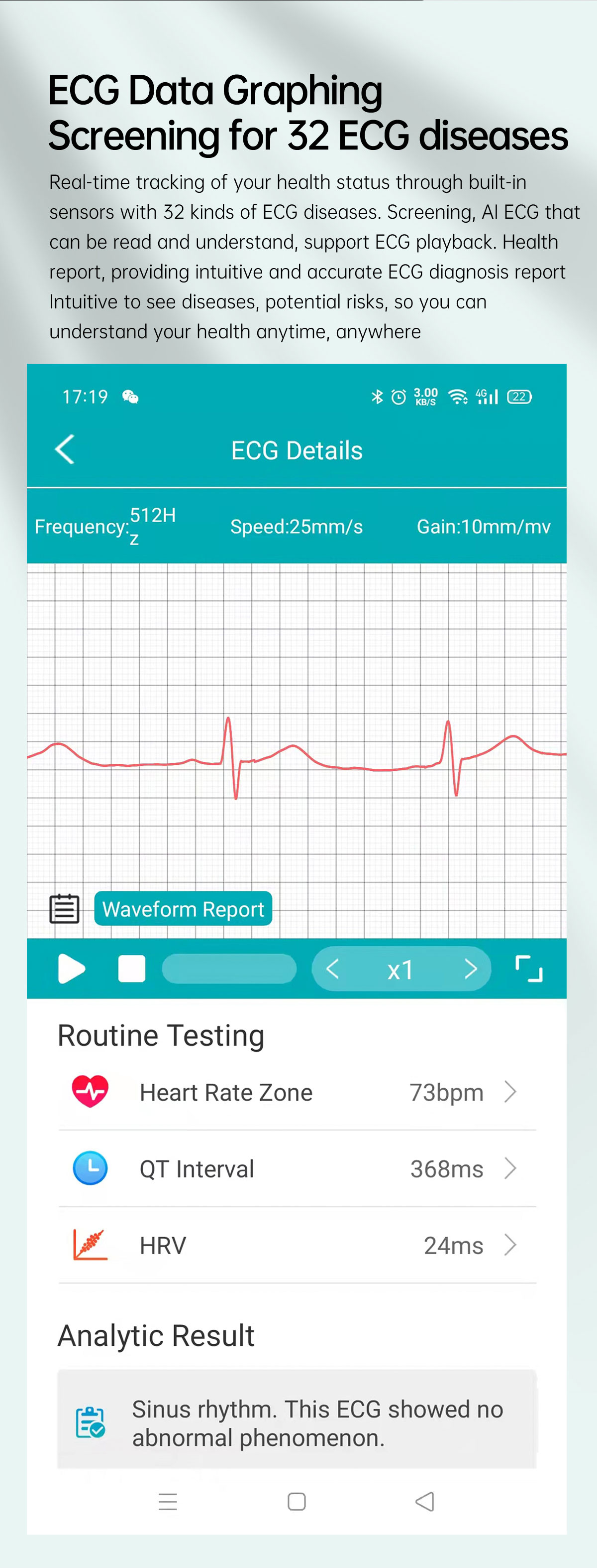 E430139inchHDTouchScreenNon-invasiveBloodSugarECGHealthBloodPressureTemperatureMeasurementSportSmart-1986759-12